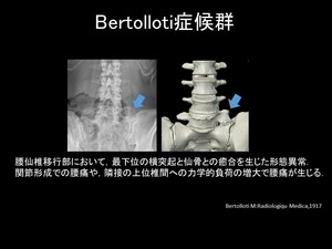 Bertolloti症候群1.JPG