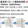 ＢＫＰで対応できない骨粗鬆症性椎体骨折とは？