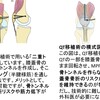 膝の不安定感を解決！MPFL再建術の2つの手法を徹底解説