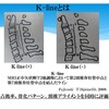 頚椎後縦靭帯骨化症（OPLL）とは？症状・原因・最新の手術方法を専門医が解説！