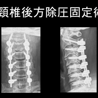 症状／疾患別　中医正骨・推拿－写真でみる準備手技と治療実技 症状／疾患別 中医正骨・推拿－写真でみる準備手技と治療実技