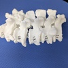 3Dプリンターが医療を変える！脊椎手術の精度を高める術前計画とは？