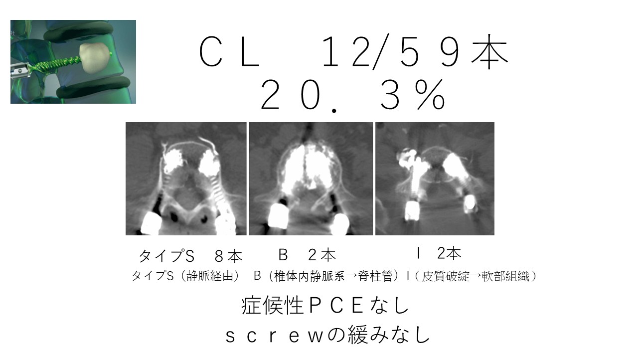 セメント漏出結果.JPG