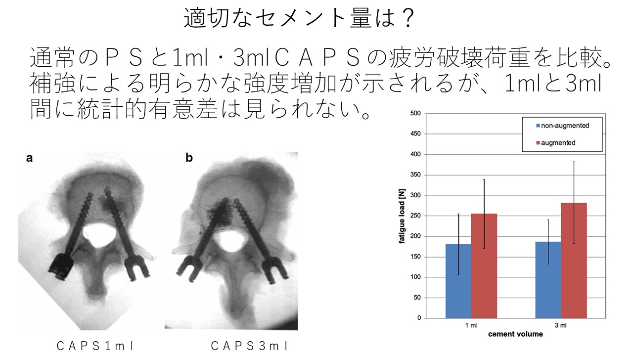 セメント適量.JPG