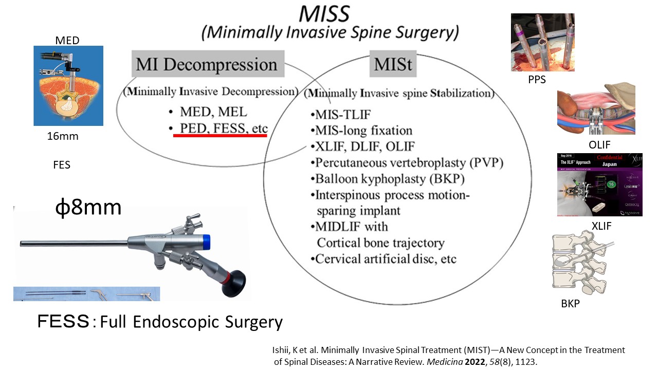 低侵襲脊椎手術の進歩PETLIF.jpg