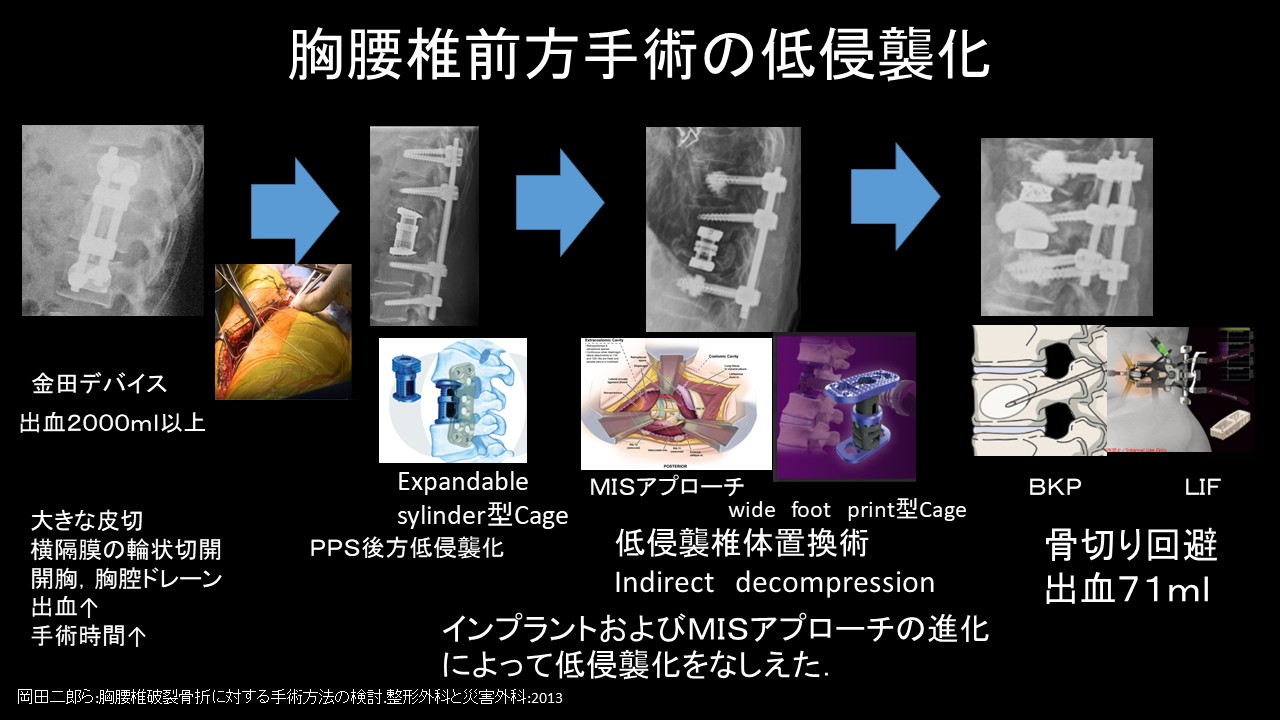 前方アプローチ低侵襲化.JPG