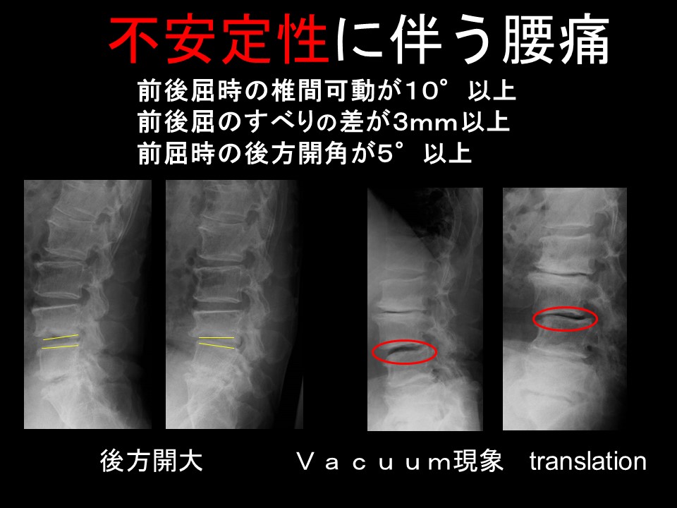 固定術の適応.jpg