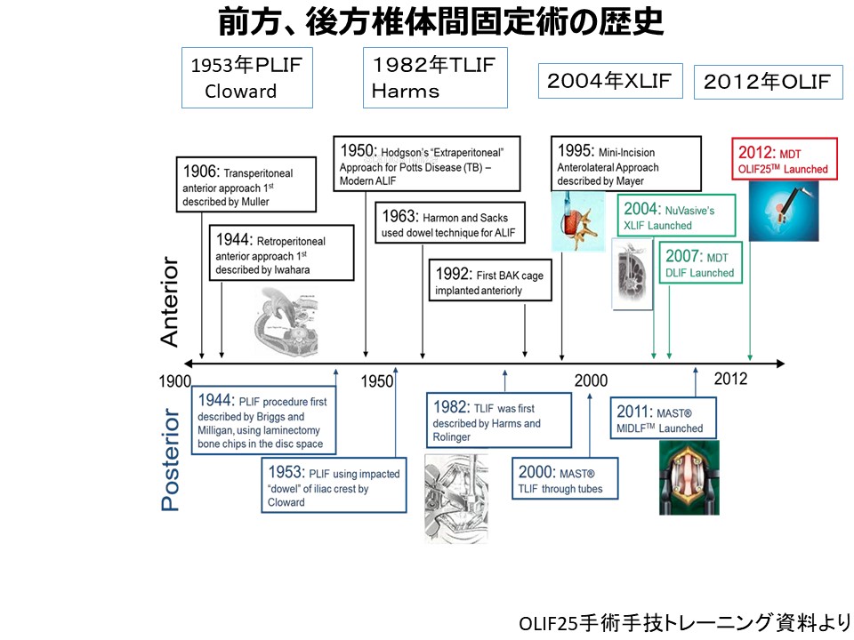 固定術歴史.JPG