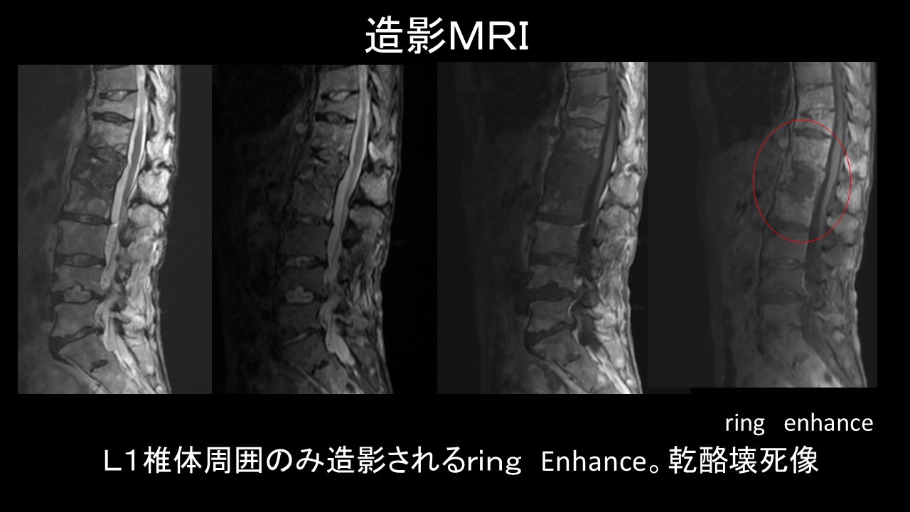 造影ＭＲＩ.jpg