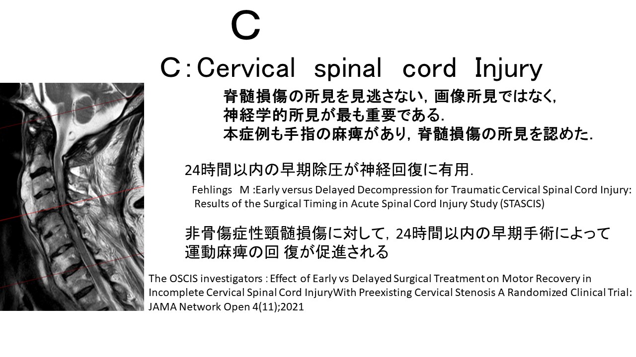 頚損Ｃ.JPG