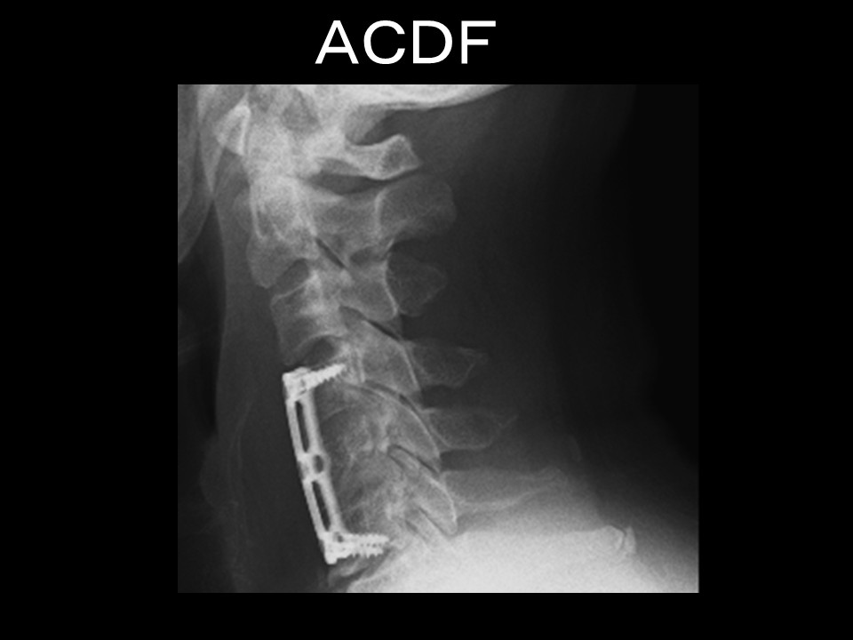 ＡＣＤＦ.jpg