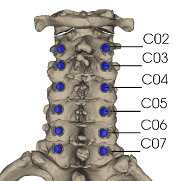 Ｍｙｓｐｉｎｅ１.jpeg