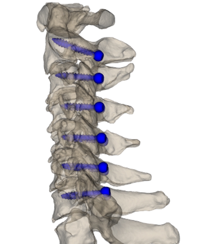 Ｍｙｓｐｉｎｅ２.jpeg