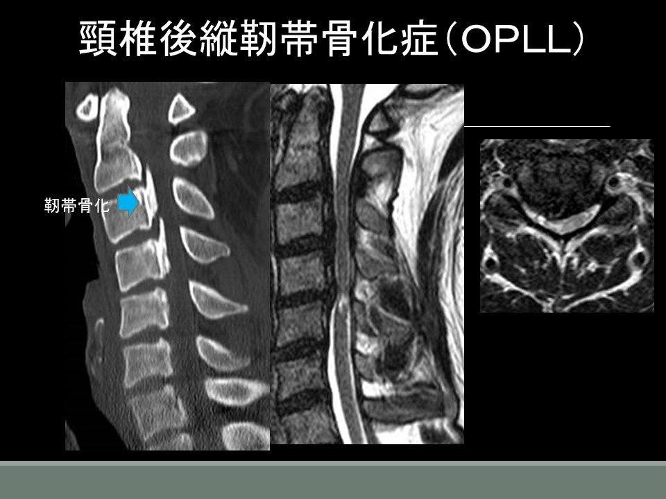 ＯＰＬＬCTMRI.jpg