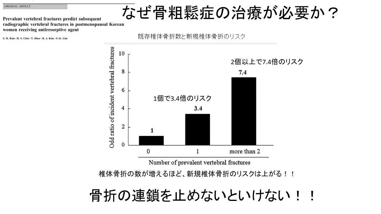 ＯＶＦ連鎖.jpg