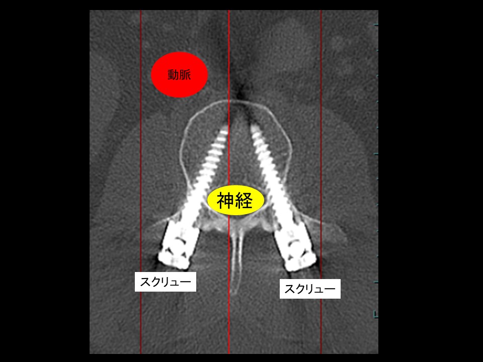 ＰＳイラスト.jpg