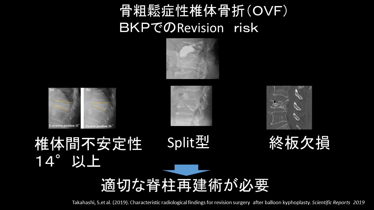 ｂｋｐ限界.JPG