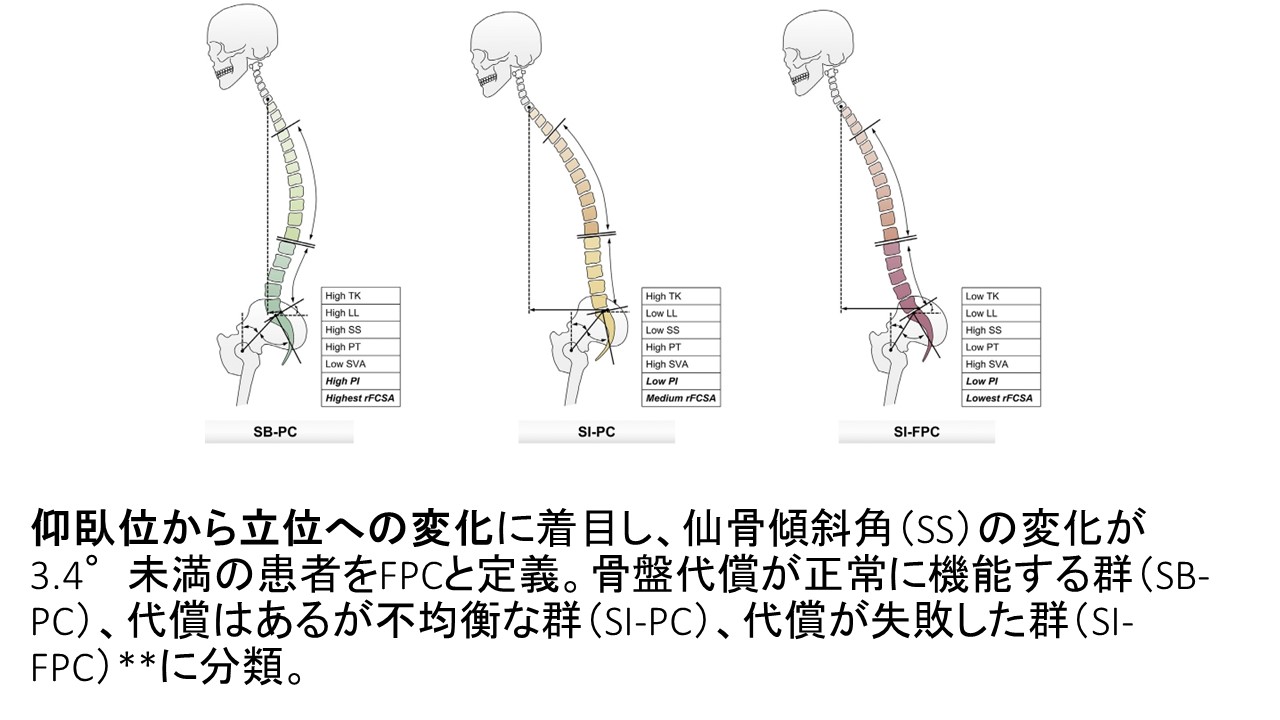 ASD骨盤代償分類2.JPG