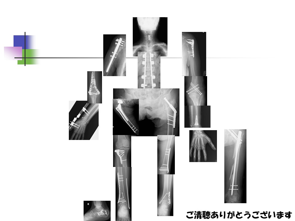 骨折治療の要点と盲点 m3電子書籍 | 整形外科 Knack & Pitfalls 骨折治療の要点と盲点