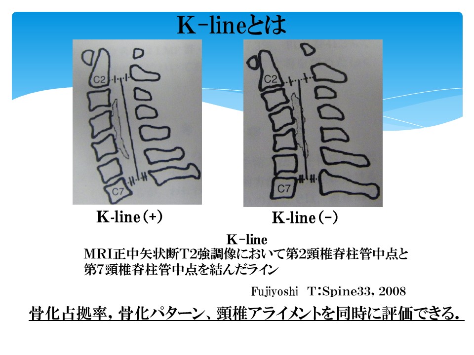 K-Line説明.jpg