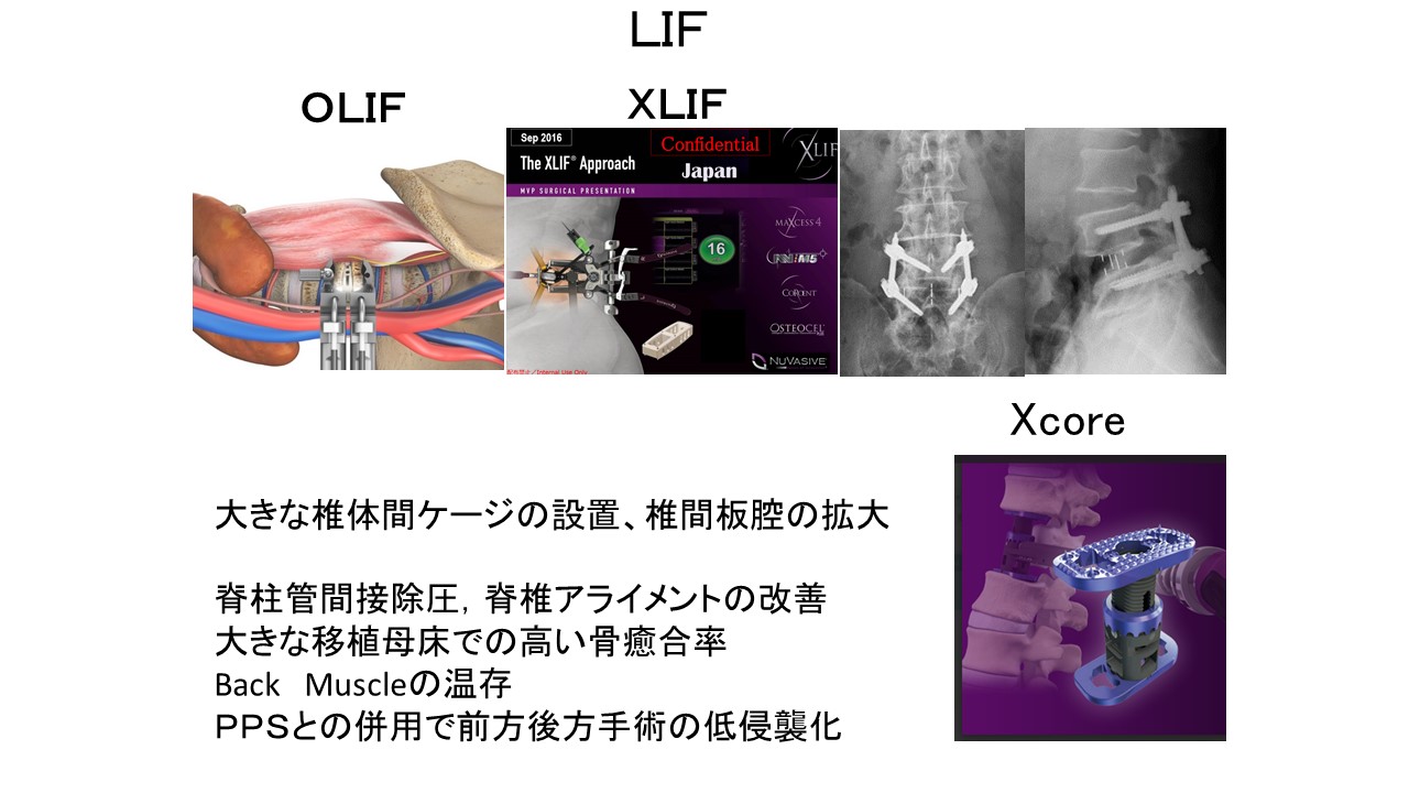 LIF図8.JPG