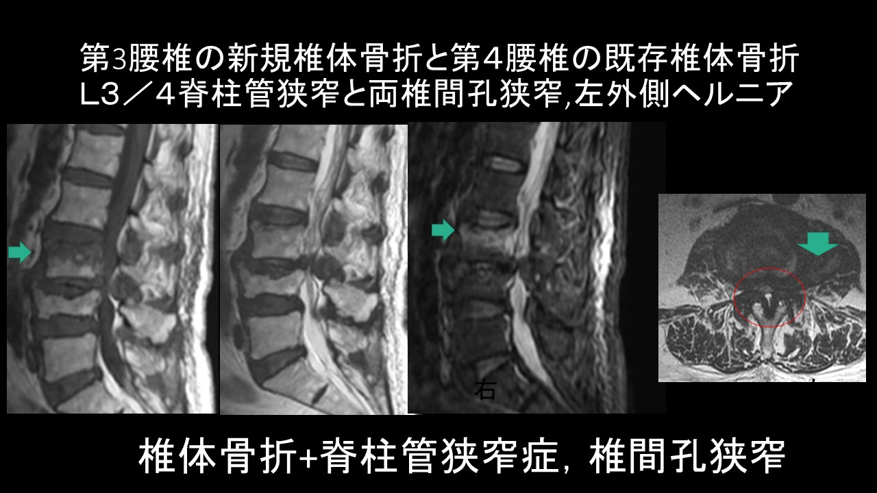 MRI.JPG