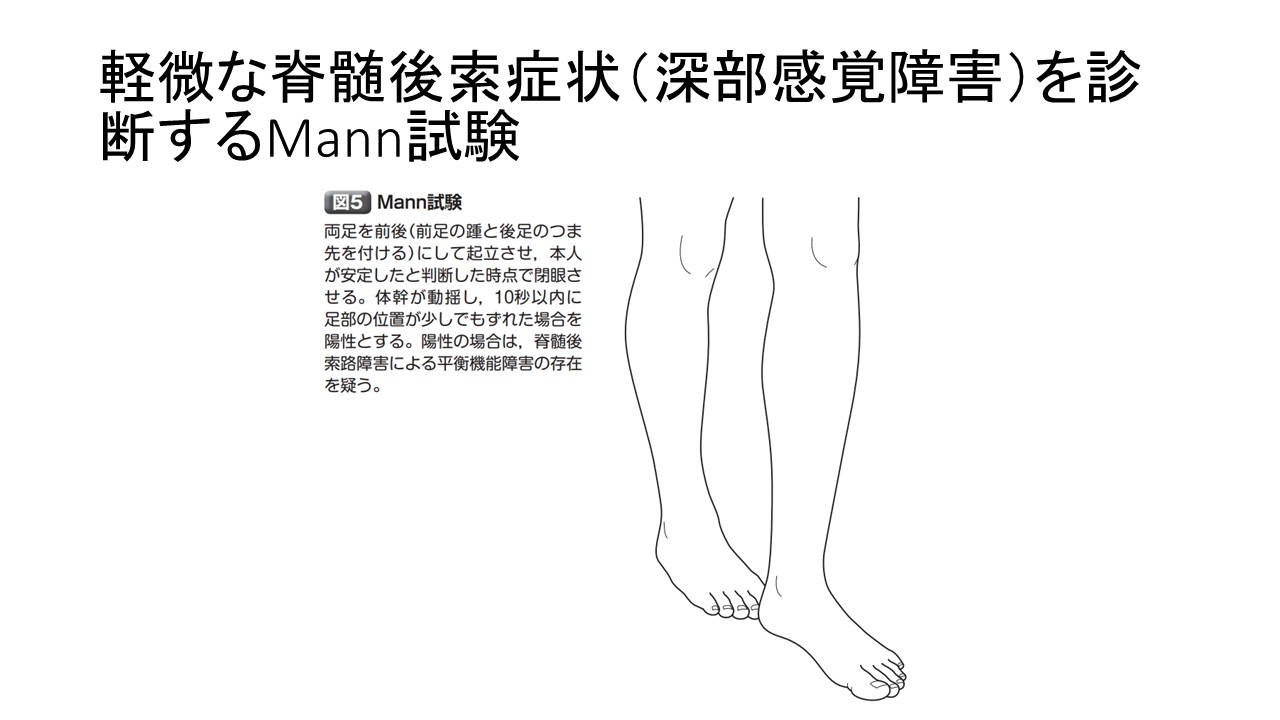 Mann試験.JPG