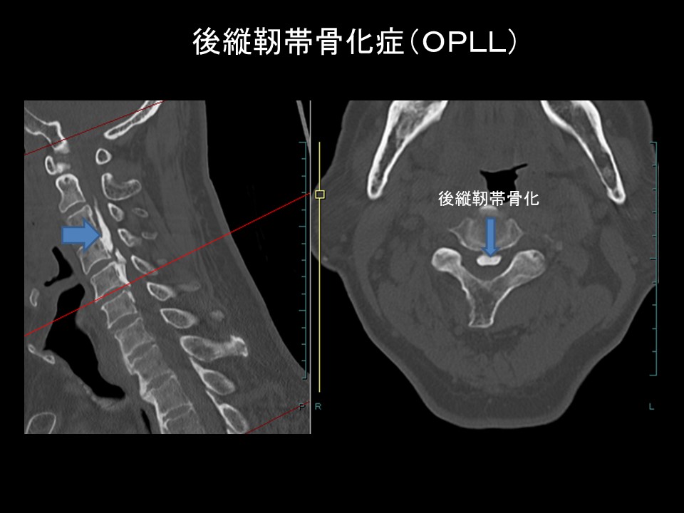 OPLL画像.jpg