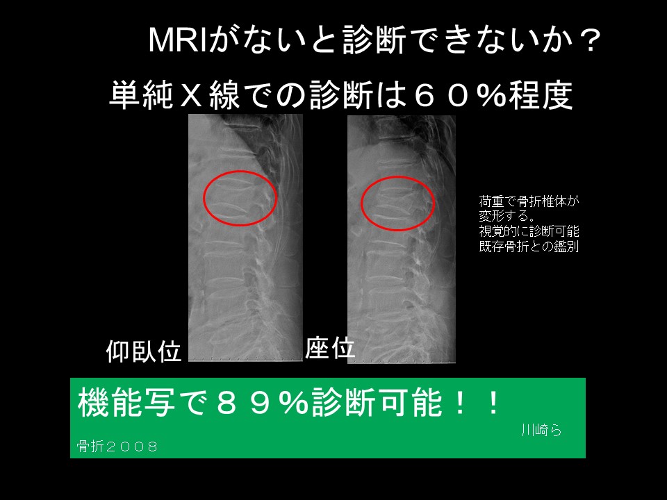 OVF機能写.jpg