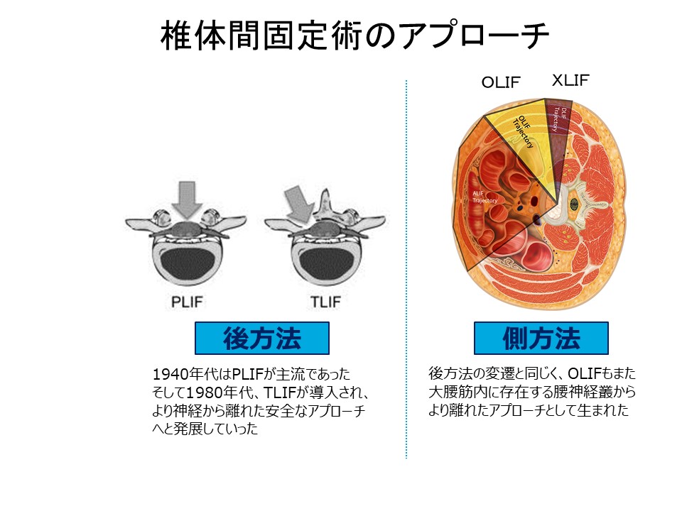 PLIFとLIF.JPG