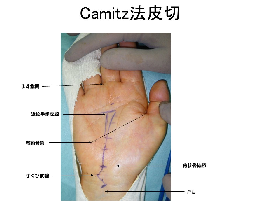 camitz皮切.JPG