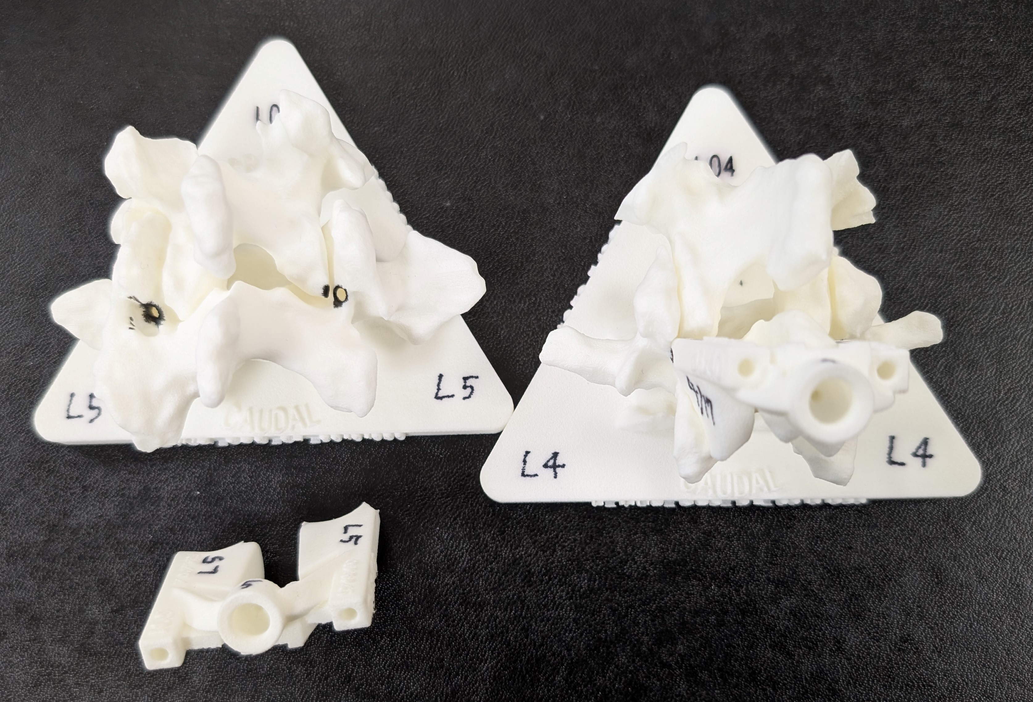 腰椎固定術が変わる！3D患者適合型ガイド（MyspineMC