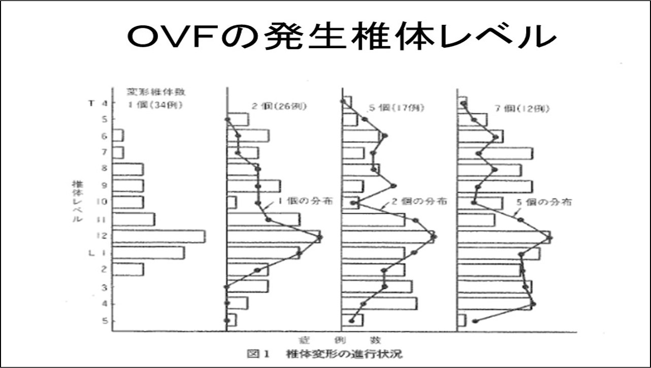 骨粗鬆症性椎体骨折（OVF:osteoporotic vertebral fracture）について 