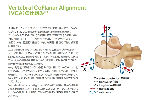 側弯症手術の最新技術をわかりやすく解説！VCA（コープレナー
