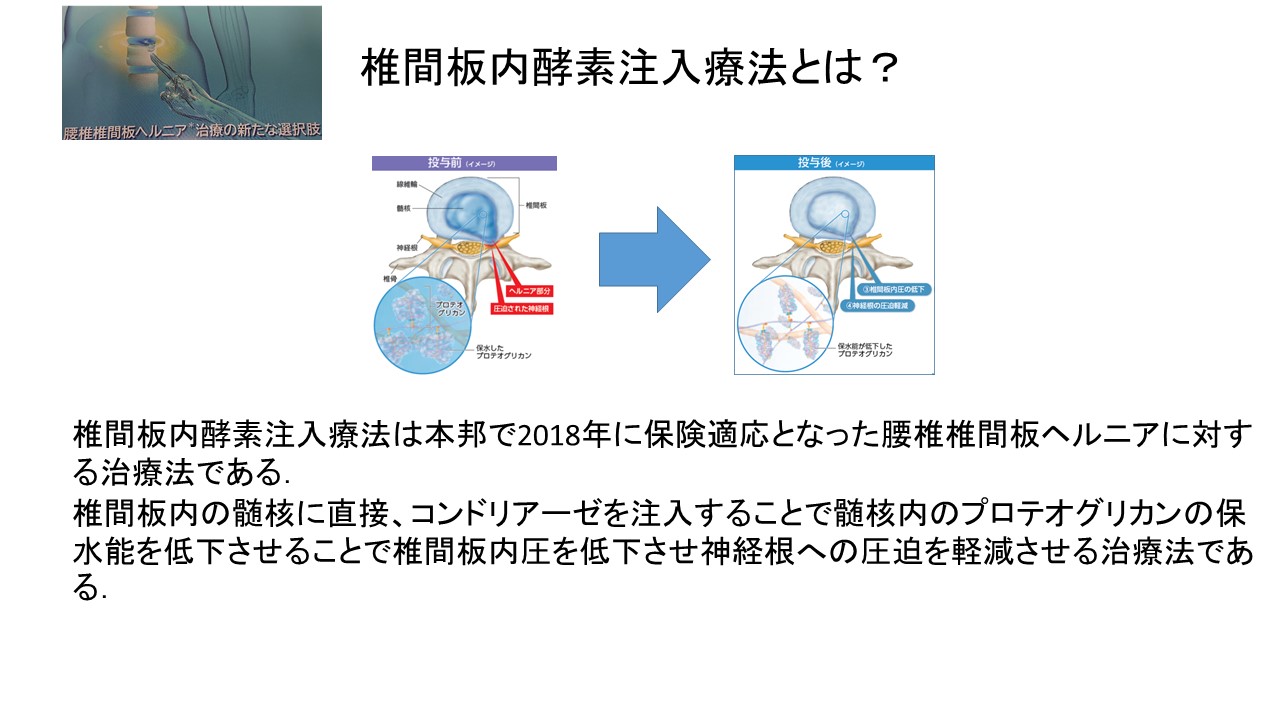 ヘルニア 椎間板内酵素注入療法（ヘルニコア注入）｜岩井整形外科病院