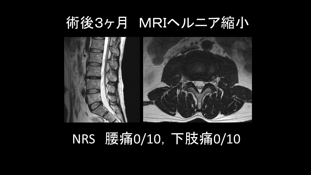ヘルニアの外科 ヘルニアの外科: 書籍／南江堂