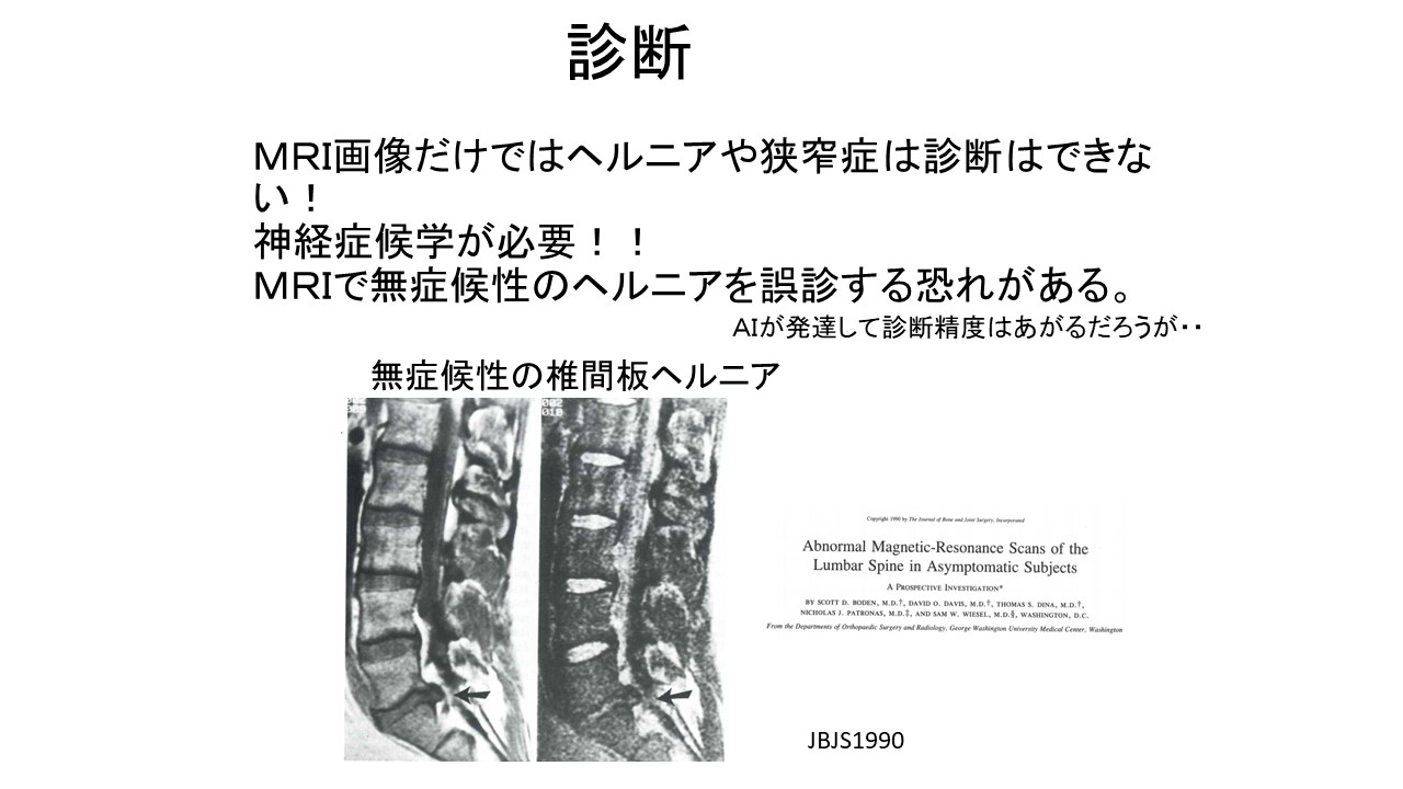 AIでの胸腰椎椎体骨折のX線診断精度 ｜ 成尾整形外科病院