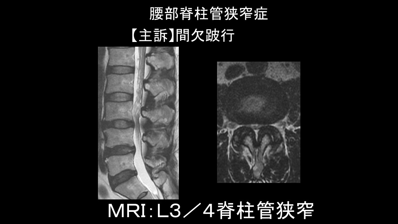脊椎の画像診断 メジカルビュー社｜画像医学・放射線医学｜脊椎の画像診断