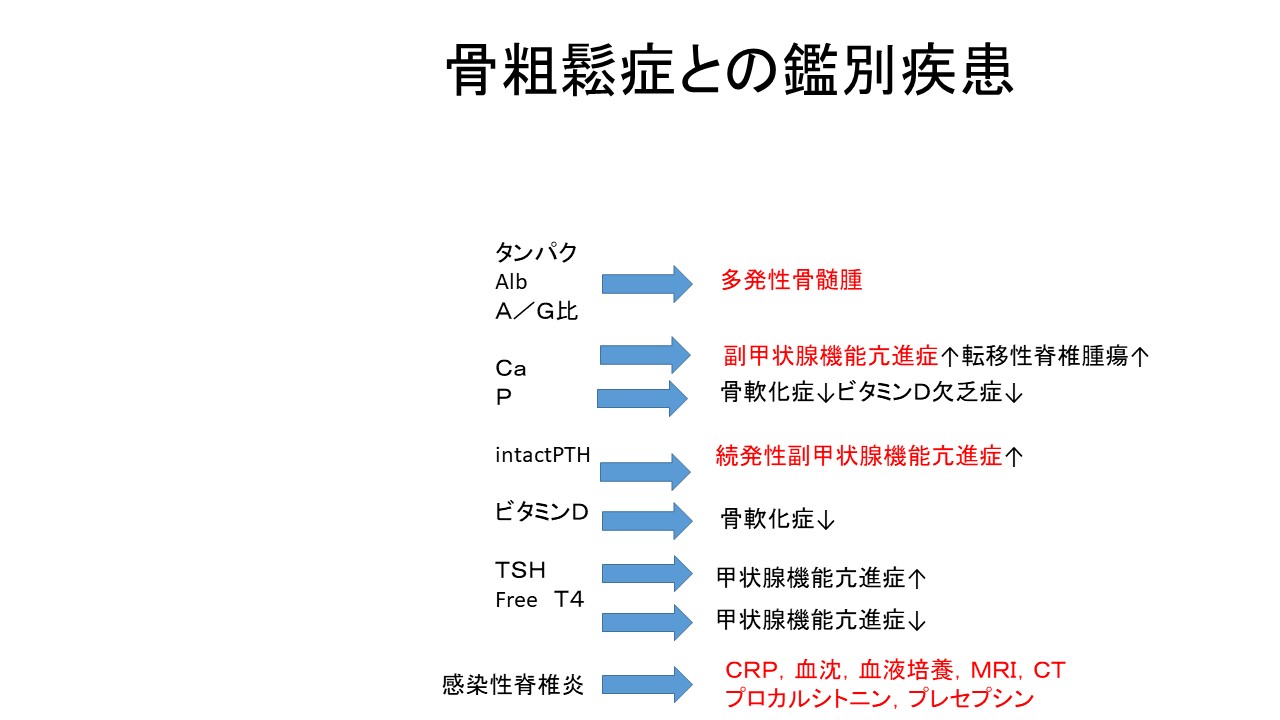 疾患別 椎体骨折の鑑別疾患には多発性骨髄腫が必須！ ｜ 成尾整形外科病院