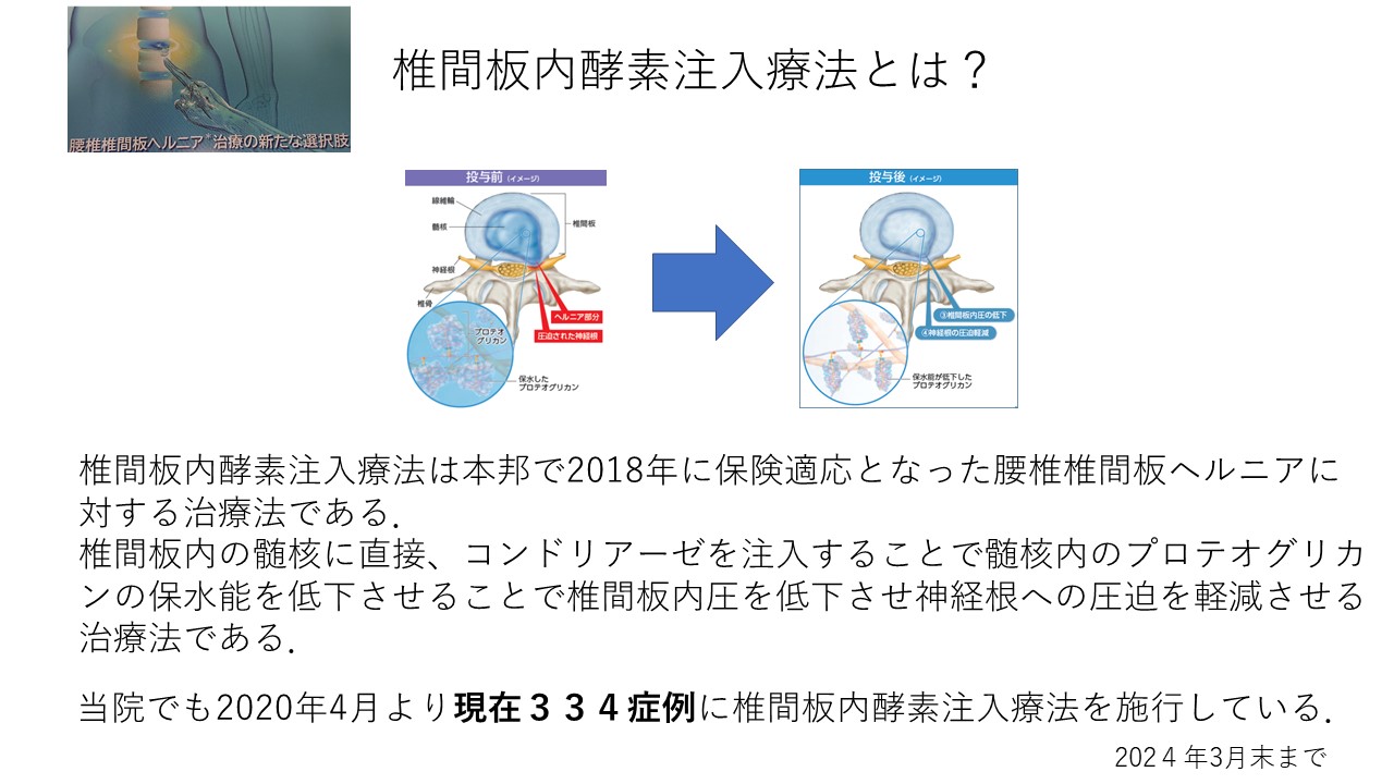 低侵襲で効果的！腰椎椎間板ヘルニア治療の新時代：椎間板内酵素注入