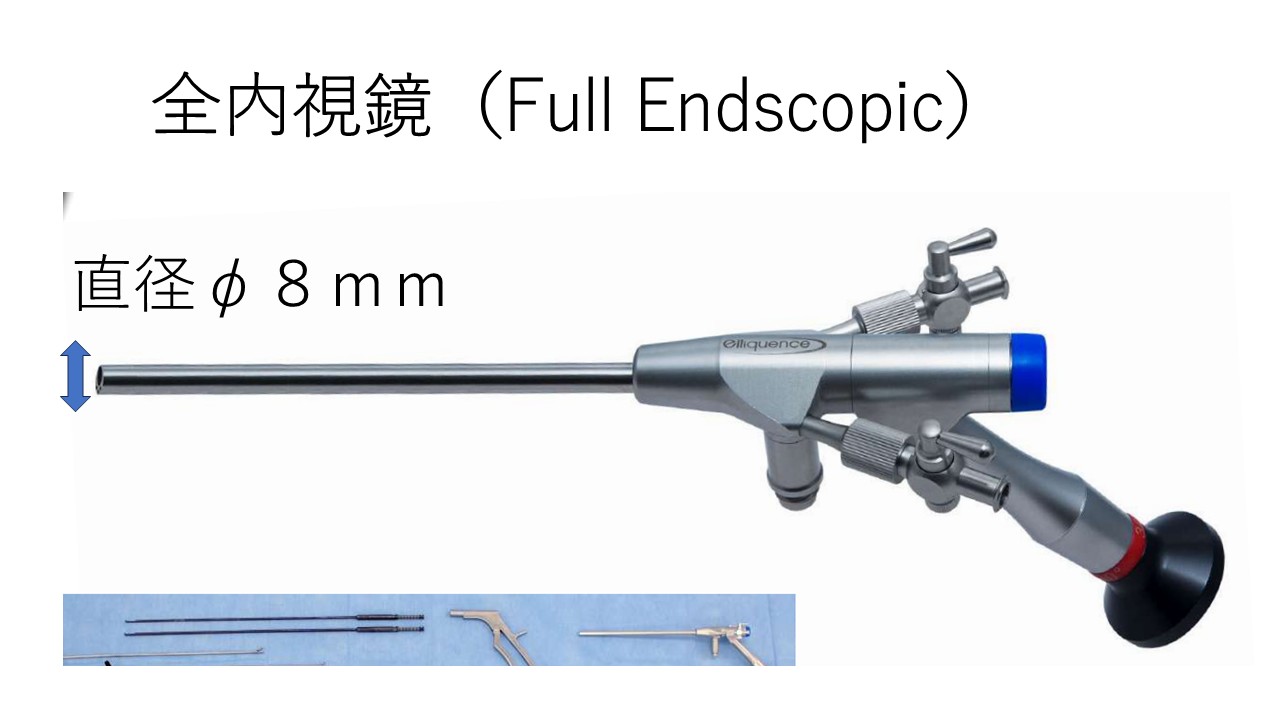椎間板ヘルニア手術の全内視鏡手術のメリットとは？全内視鏡 vs 開放
