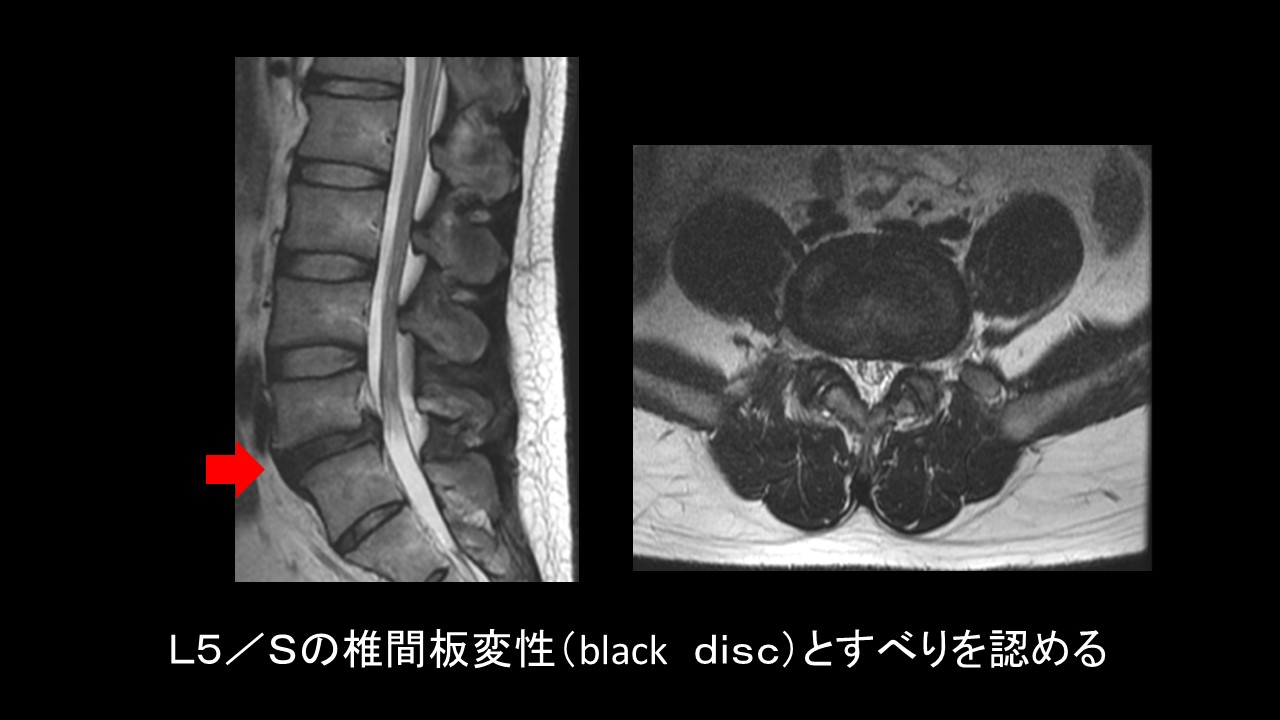 MRIとスポーツ医学 MRIのご紹介｜地方独立行政法人 佐世保市総合医療センター