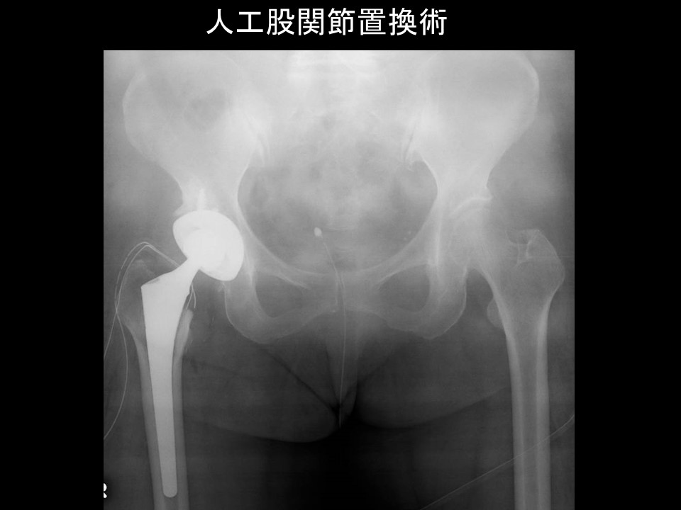 関節センター｜医療法人寿尚会 洛陽病院｜人工関節・人工透析